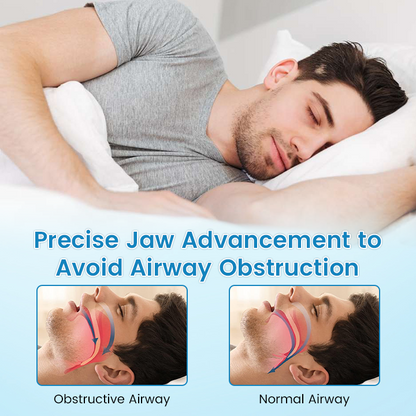 LAST DAY SALE 60% OFF⏰PerfectSleep Solution- Anti-Snoring & Anti-Grinding Teeth Protector